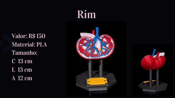 Rim